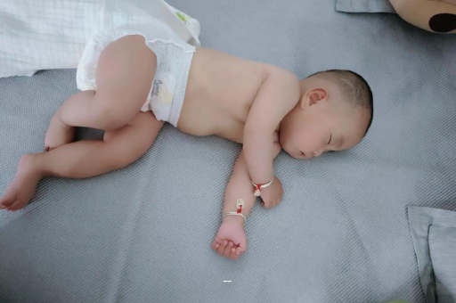 镇江宝宝突然很多眼屎
